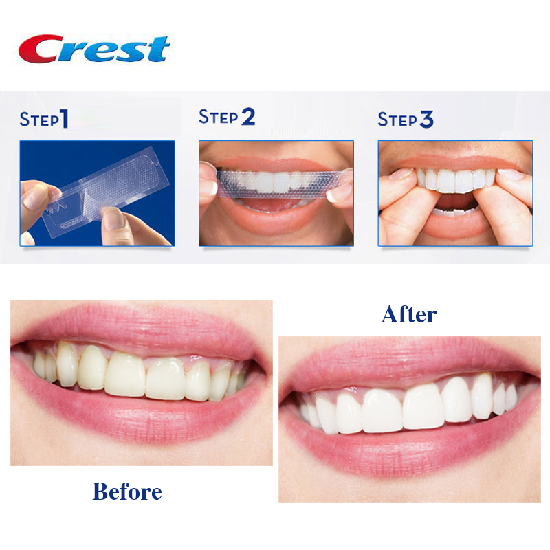 Miếng dán trắng răng Crest 1Hour Express Levels 18 Whiter - Image 5